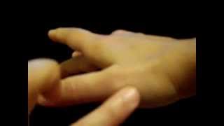 Thumb Collateral Ligaments Test [upl. by Krilov431]