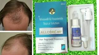 ALLCURE MF Topical Solution Minoxidil amp Finasteride Topical Solution [upl. by Atilem412]