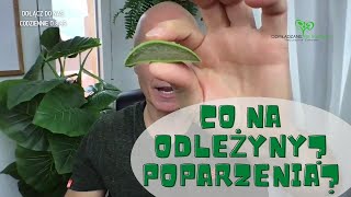 Co na odleżyny Oparzenia przeszczep skóry … [upl. by Willabella]