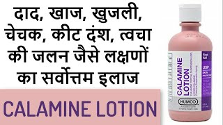 Calamine lotion  Superb remedy for mild skin infections [upl. by Ahselak]