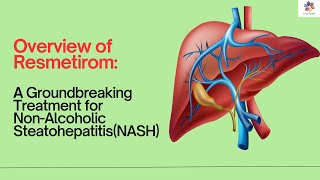 Resmetirom Transforming Lives with Advanced NASH Treatment II Groundbreaking Treatment [upl. by Zendah995]