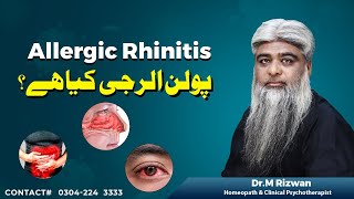 Allergic Rhinitis [upl. by Herahab]