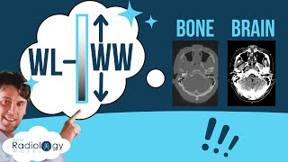 Window Width and Level CT Physics Head Chest AbdomenSpine [upl. by Eelloh]