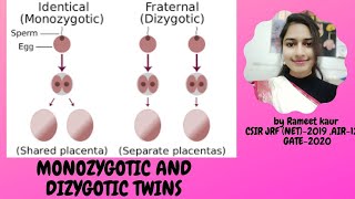 Monozygotic and Dizygotic twins [upl. by Ignazio140]