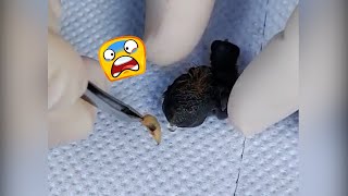 Bot Fly Removal Gives Baby Birds New Life  Squeaky Clean [upl. by Naujd]