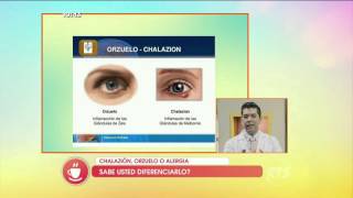 ¿Sabe usted diferenciar el chalazión el orzuelo o la alergia [upl. by Ahteres52]