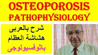 Osteoporosis Pathophysiology شرح بالعربى هشاشة العظام باثوفسيولوجى [upl. by Gunner]