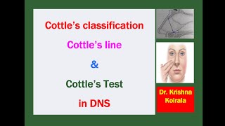 What are Cottles classification Cottles test and Cottles maneuver in DNS drkrishnakoirala [upl. by Lorry]