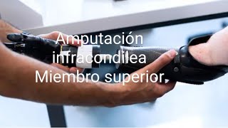 Amputación Infracondilea Miembro superior fisioterapia [upl. by Imhskal]