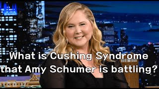 What is Cushing Syndrome that Amy Schumer is battling [upl. by Ofella]