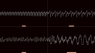 Oscilloscope repellantmold  a432 [upl. by Llerihs]