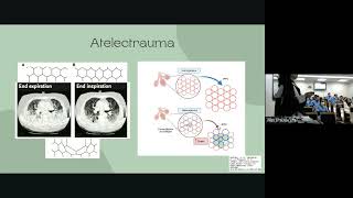 VILI  VENTILATOR INDUCED LUNG INJURY [upl. by Vey893]