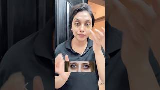 Remove Dark circles and eye puffiness in just 7days💯 [upl. by Ahsiatal584]