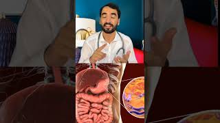 What is h pylori and its treatment 🤔 dradnankhan duet indianmusic adnankhan [upl. by Reifnnej]