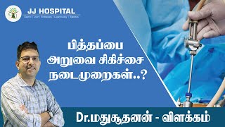 Laparoscopic Cholecystectomy  Gallbladder Surgery Procedures  Tamil  J J HOSPITAL [upl. by Notterb]