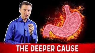 The Real Causes of Acid Reflux Heartburn amp GERD – DrBerg [upl. by Aliehc262]