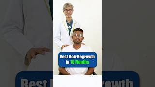 100 Hair Regrowth in Just 10 Months  Adon Hair Care  Testimonial  Hair Expert  Hair Loss viral [upl. by Eddra]