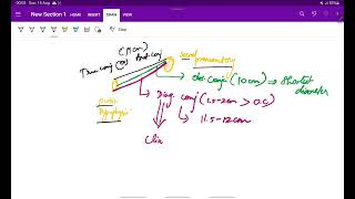 Human Pelvis  Anatomy  Obstetrics  OG  Easy notes  MeDTecH29 [upl. by Einamrej811]