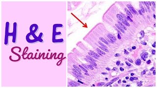 H amp E staining  Hematoxylin amp Eosin staining [upl. by Soirtemed719]