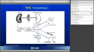 IX Ateneo CACI 2013  quotAngioplastia Renalquot [upl. by Cob119]