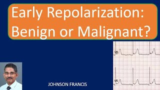 Early Repolarization Benign or Malignant [upl. by Araek]