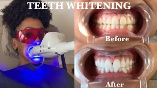 TEETH WHITENING WITH ICYBITESCO  AMAZING RESULTS [upl. by Semmes]