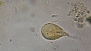 Giardia Lamblia CIAB wwwciabes [upl. by Libys601]