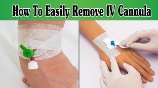 IV Cannula Removal Procedure  Tips and Tricks [upl. by Yessac]