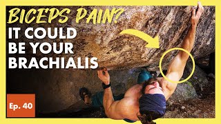 Why the Brachialis Muscle Causes Biceps and Elbow Pain in Climbers [upl. by Pattie]