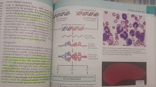 Chronic Myeloid Leukemia  SPECIAL PATHOLOGY [upl. by Aelyak879]