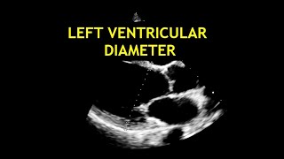 How to measure the LEFT VENTRICULAR DIAMETER Echocardiography [upl. by Airehc356]