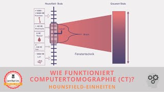 Wie funktioniert CT HounsfieldEinheiten [upl. by Batty]