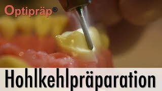 Tutorial Hohlkehlpräparation mit Optipräp® [upl. by Mastat]