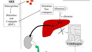 biochimie des ictères partie 3 [upl. by Pevzner]