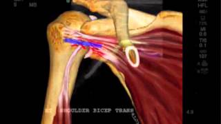 Fallstudie FujiFilm SonoSite Pathologie der Vorderschulter [upl. by Adnahsal]