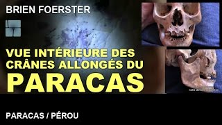 Vue intérieure dun crâne allongé du ParacasPérou par Brien Foerster VOSTFR [upl. by Elatnahc38]