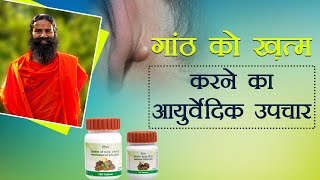 Ayurvedic Treatment for Lipoma गांठ  Swami Ramdev [upl. by Arakawa]