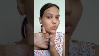 Use of Color corrector pallate 🥰 skincare skincareproducts beautytips beautyproducts shorts [upl. by Acirret]