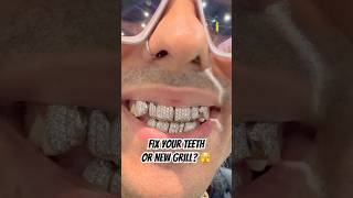 Fix your teeth or get a grill 😱 johnnydang grillz teeth diamond jewelry dentist shorts [upl. by Danyluk759]