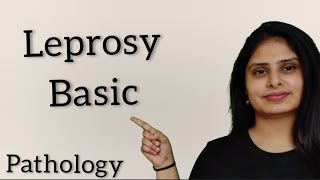 Leprosy in hindi  Leprosy pathology in hindi [upl. by Eiramadnil707]