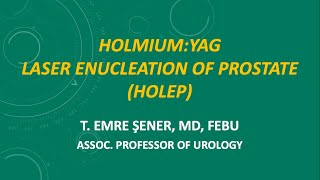 Enbloc HoLEP with Early Apical Release using a Low Power Laser [upl. by Cordeelia]