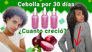 JUGO DE CEBOLLA para el CRECIMIENTO DEL CABELLO😱 ANTES Y DESPUÉS Funciona🤔 [upl. by Yseulta]