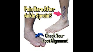 After Ankle Sprain and Surgery Check Your Foot Alignment [upl. by Mehcanem]