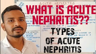 What is Acute NephritisTypes of acute nephritisDIALYSIS [upl. by Ilil]