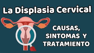 LA DISPLASIA CERVICAL Causas signos y síntomas diagnóstico y tratamiento [upl. by Adnav702]