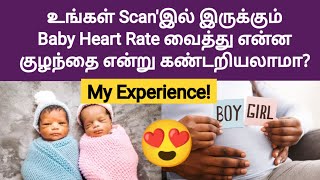 pregnancy baby heart rate boy or girl in tamil  boy or girl symptoms in pregnancy tamil  boy baby [upl. by Adela]