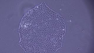 Assessing iPSC Morphology [upl. by Nosa]