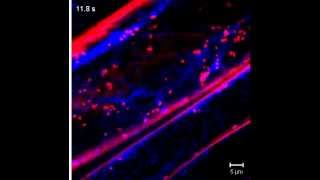 Fluorescent Golgi bodies and endoplasmic reticulum in arabidopsis seedling [upl. by Otit]