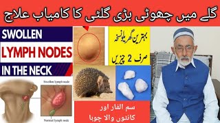 Swollen Lymph Nodes in Neck  Gale ki Gilti ka ilaj  Kanthmala ka ilaj  Neck lump treatment [upl. by Phia]