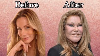 The Story Of JOSELYN WILDENSTEIN aka Cat woman  Plastic Surgery Billionaire marriage and more [upl. by Ojimmas847]